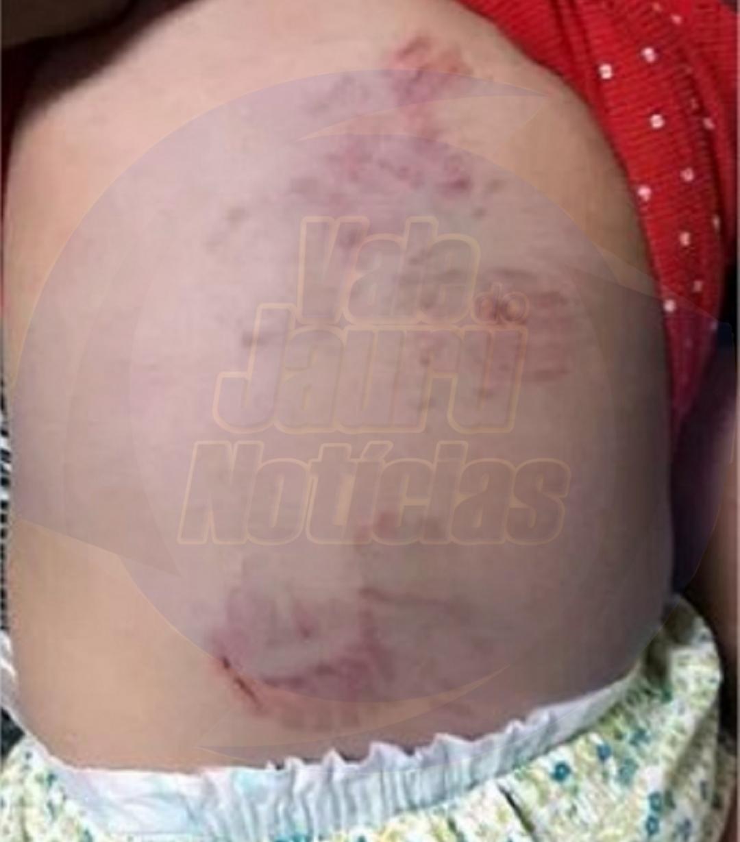 Mulher é detida suspeita de maus-tratos à filha de 10 meses em MT