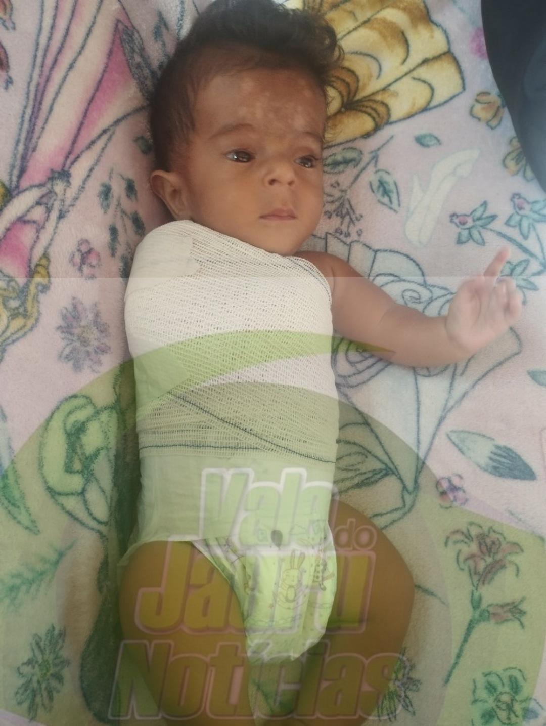 Bebê de 9 meses diagnosticado com ‘ossos de vidro’ sofreu seis fraturas desde que nasceu em MT