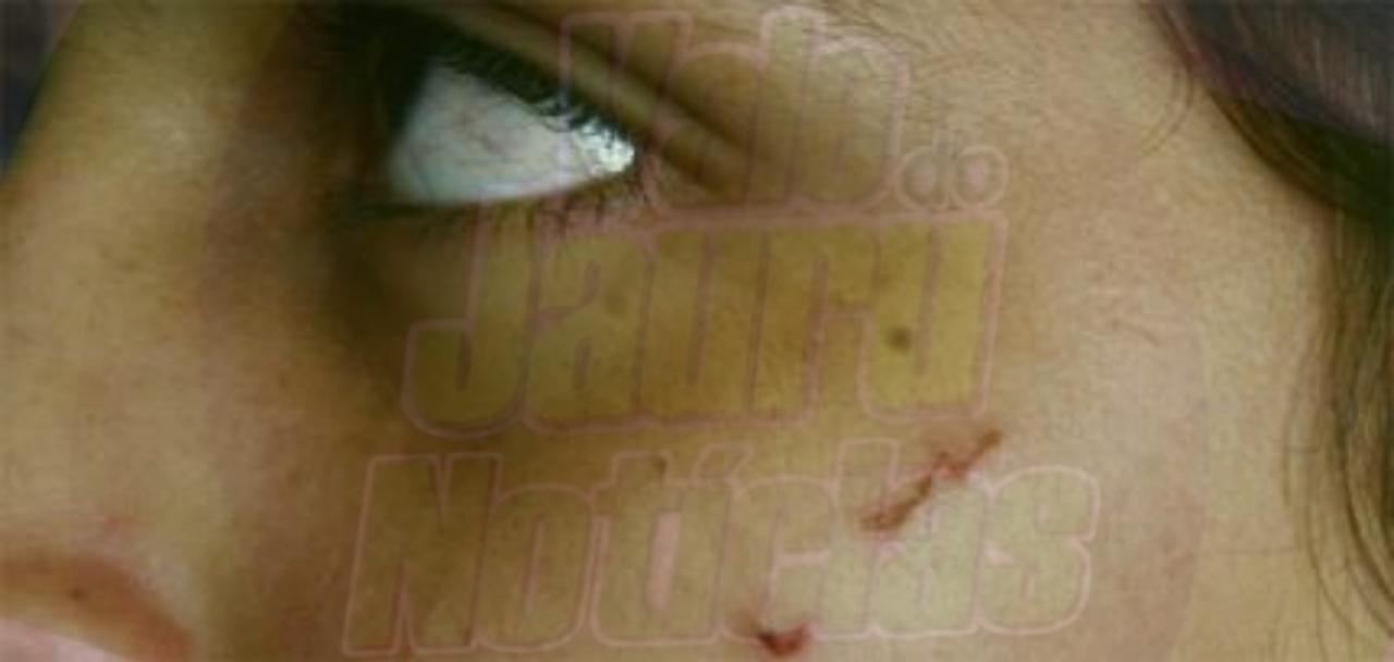 Marido é preso por ferir mulher com caco de vidro após briga