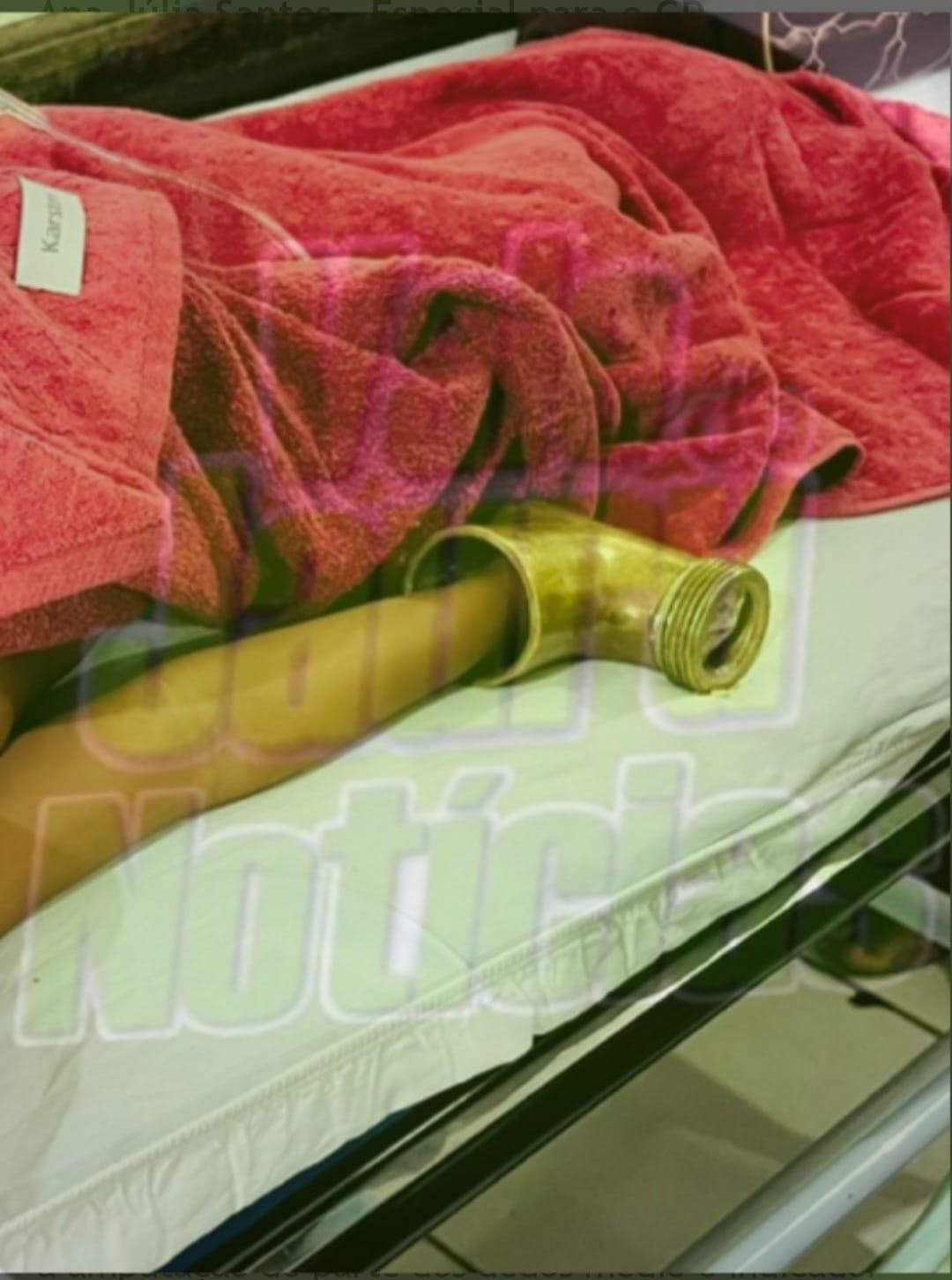 Menina de 4 anos perde dedos após mão ficar presa em tubo