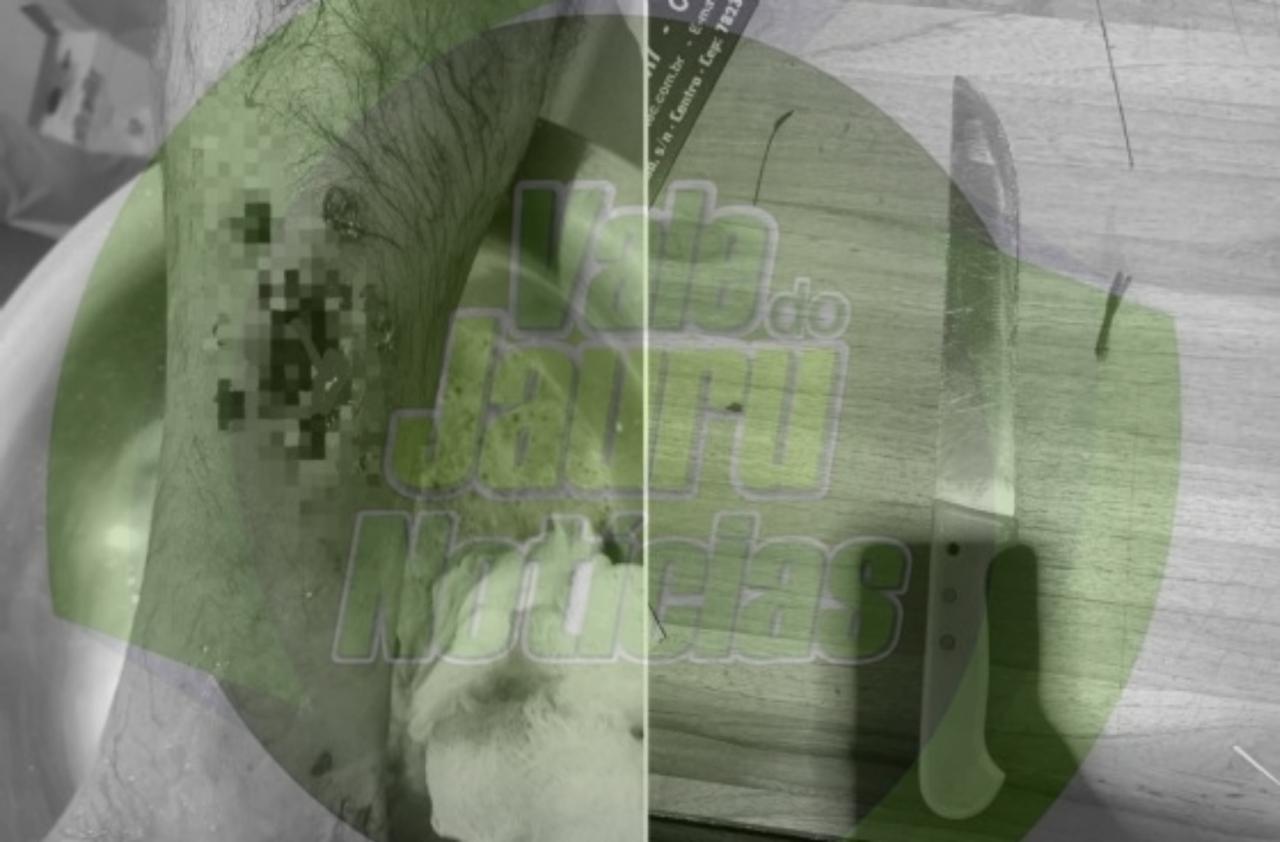 Suspeito leva tiro de borracha da PM ao tentar invadir casa da ex-mulher