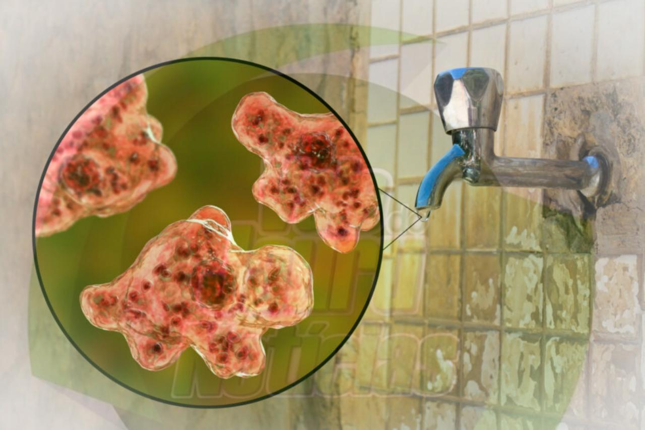 Homem contrai ameba comedora de cérebro ao usar torneira na Flórida, EUA