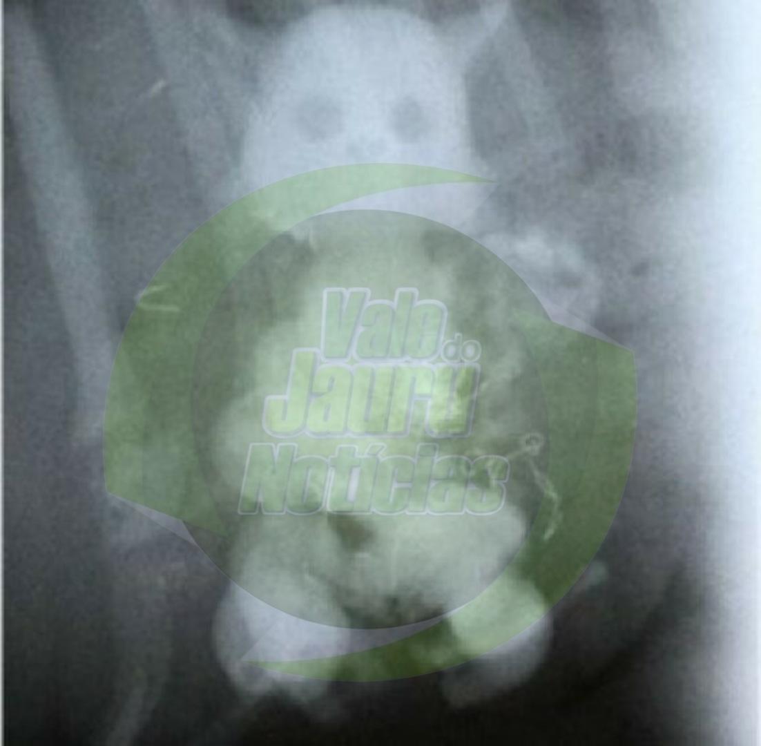 Idoso é atendido em unidade de saúde de MT com boneca introduzida no ânus