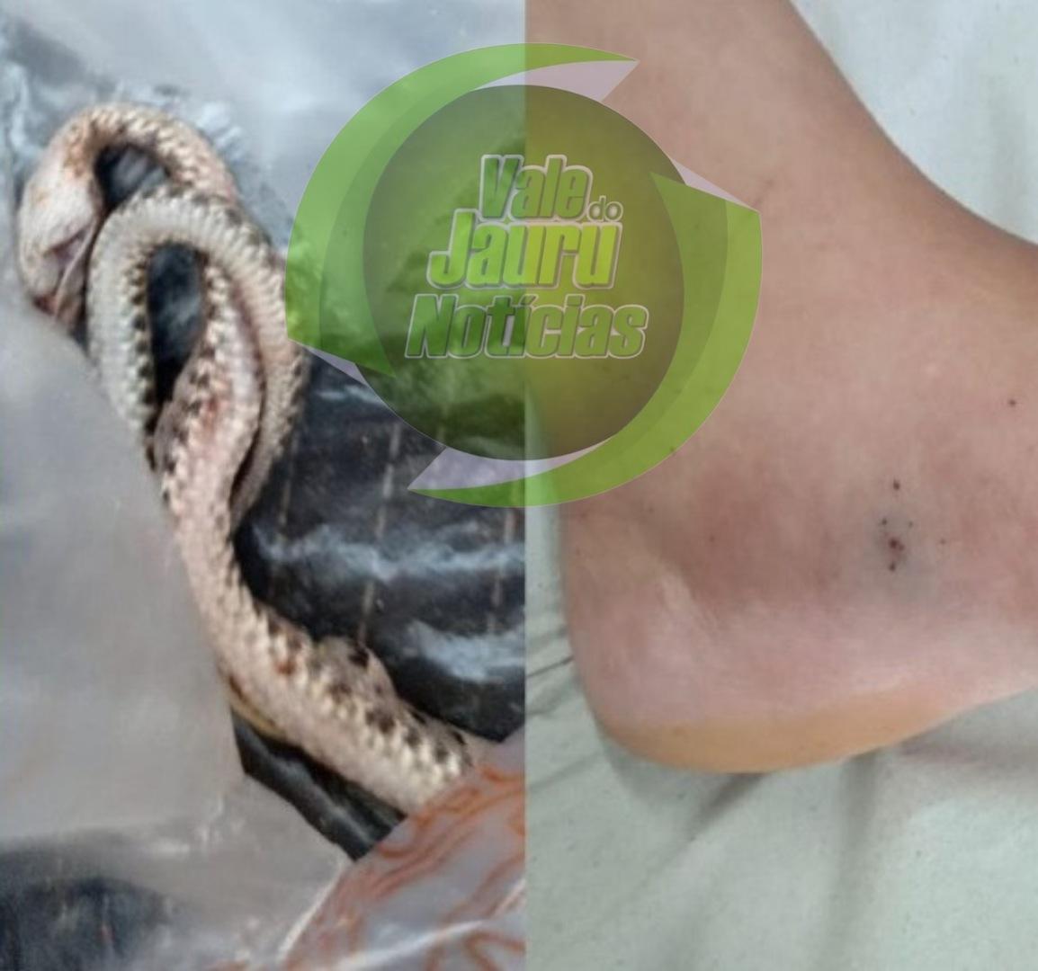 Mulher morre após ser picada por jararaca em Chapada