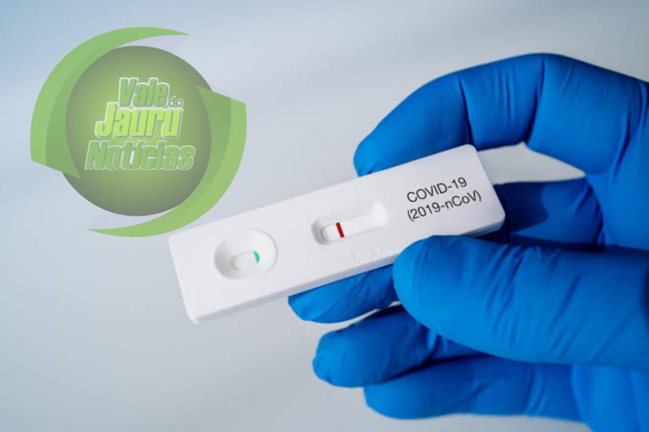 Anvisa deixa de exigir comprovante do teste de Covid-19 para entrada no País