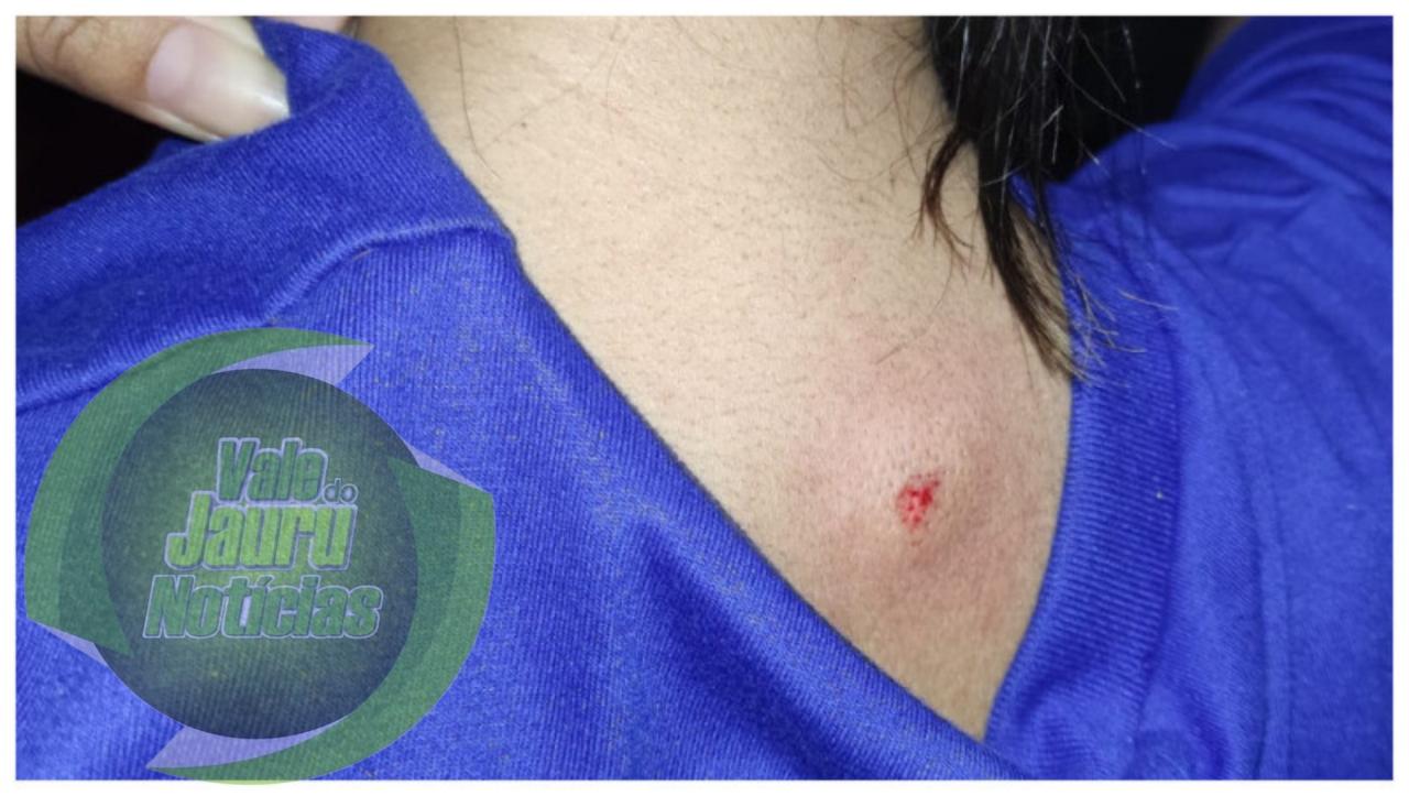 Atirador usa arma de pressão para disparar em pessoas andando na rua