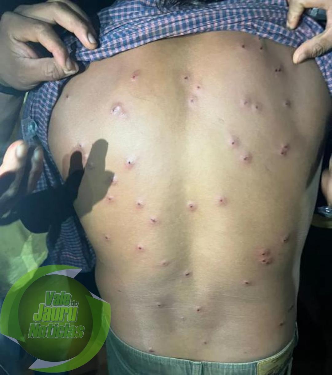 Indígenas acabam baleados com bala de borracha em confronto com seguranças de PCHs em Campos de Júlio