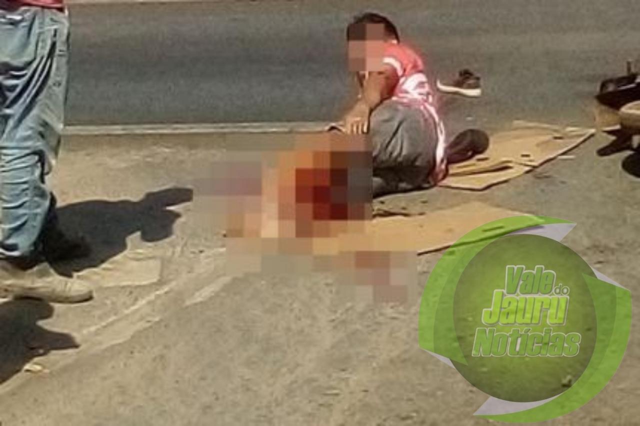 Motociclista tem perna esmagada em acidente na Rodovia