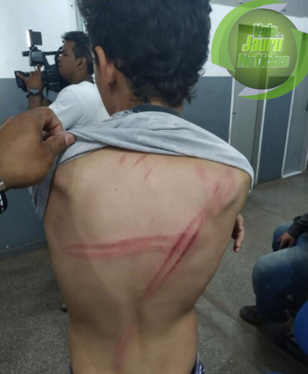 Extrema violência: Padrasto é preso por torturar enteado de 11 anos que não queria beijar menina