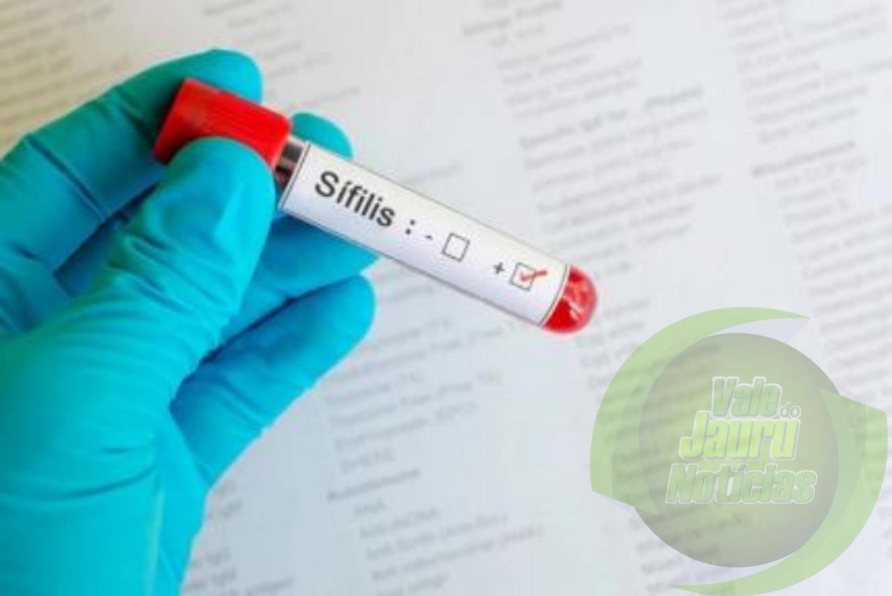 MPF verifica medidas de combate à sífilis em Mato Grosso após relatório de universidade