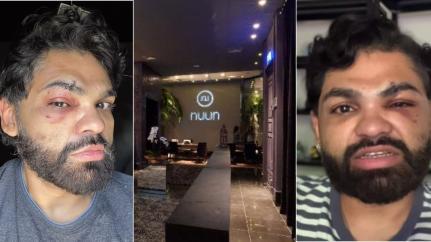 Suspeito de agredir psicólogo já foi preso por racismo na Nuun