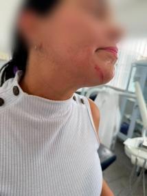 Servidora é agredida por paciente em unidade de saúde.