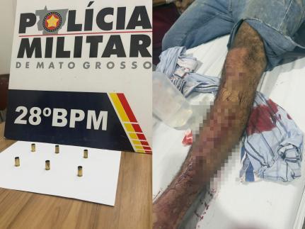 Criminoso atira 6 vezes contra vítima, que é atingida por um tiro na perna.