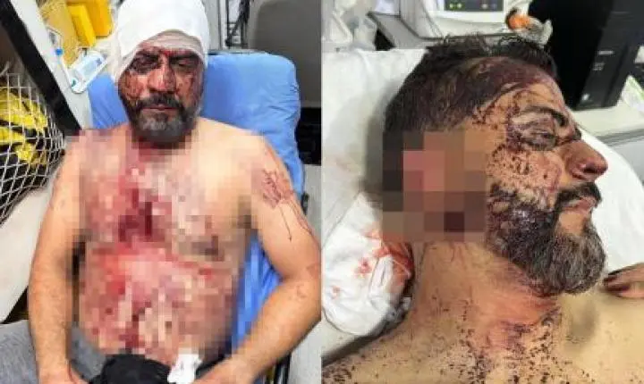 Bandidos exigem R$ 1 milhão, cortam orelha de vereador e ameaçam arrancar braço do filho.
