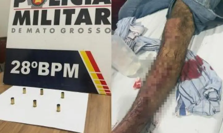 Criminoso atira 6 vezes contra vítima, que é atingida por um tiro na perna.